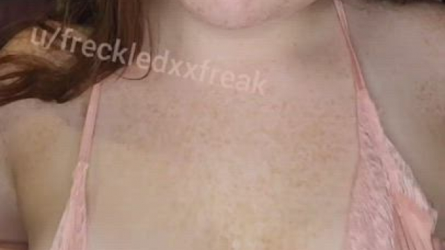 freckled girls do it best